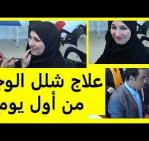 Embedded thumbnail for علاج شلل الوجه النصفي في المنزل