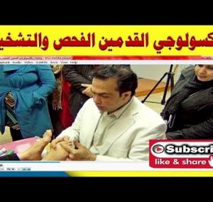 Embedded thumbnail for رفلكسولوجي القدمين الفحص والتشخيص